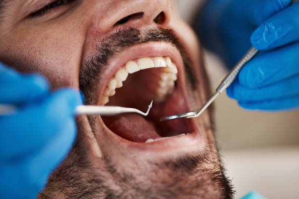 Best Mobile Emergency Dentist in Pleasant Hill, OH
